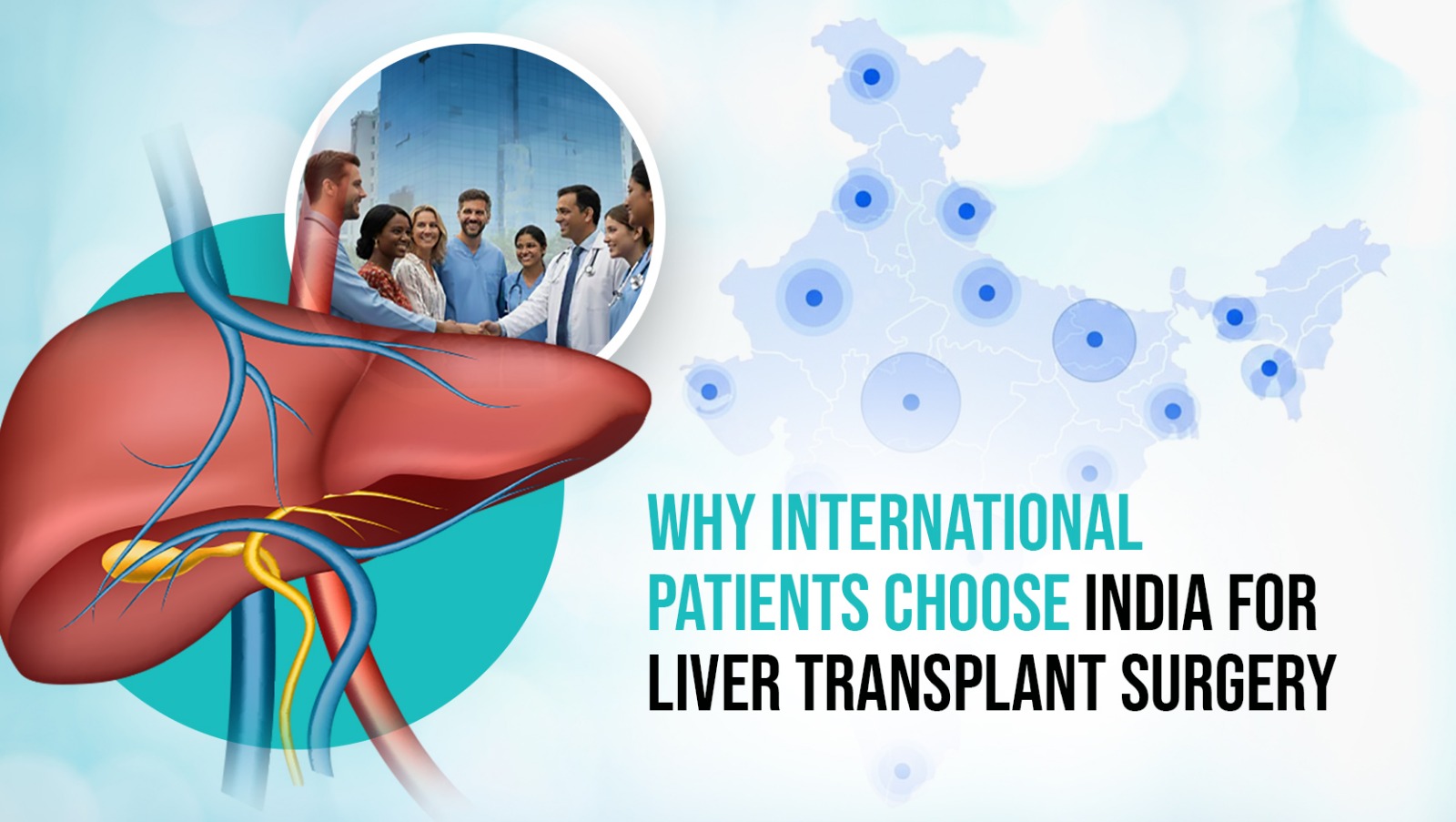 An infographic titled "Why International Patients Choose India for Liver Transplant Surgery." The image features a detailed medical illustration of a human liver in the foreground. In the background, there is a stylized map of India with blue circular markers indicating medical hubs, alongside a circular inset photo showing a diverse group of international patients shaking hands with a smiling Indian medical professional.