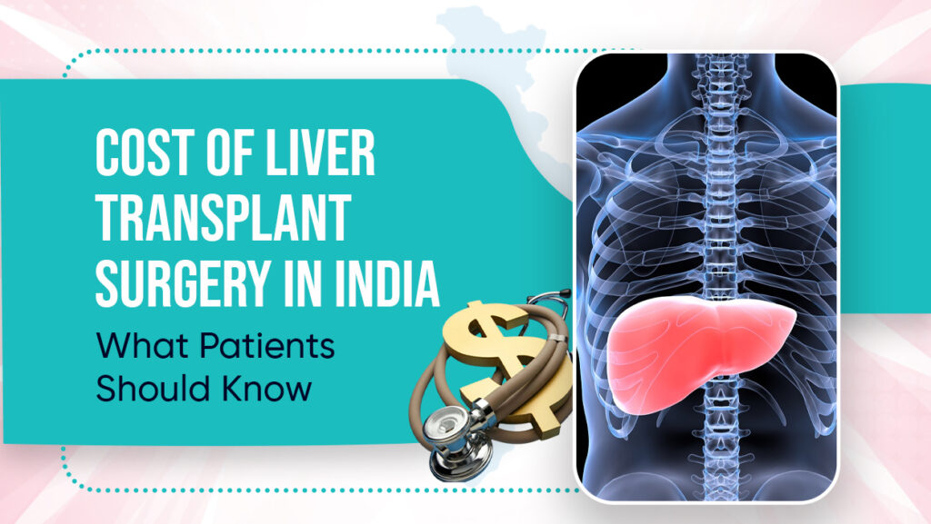 Graphic illustration of a human liver combined with a dollar symbol, representing the cost of liver transplant surgery in India, by Retentia Life Care